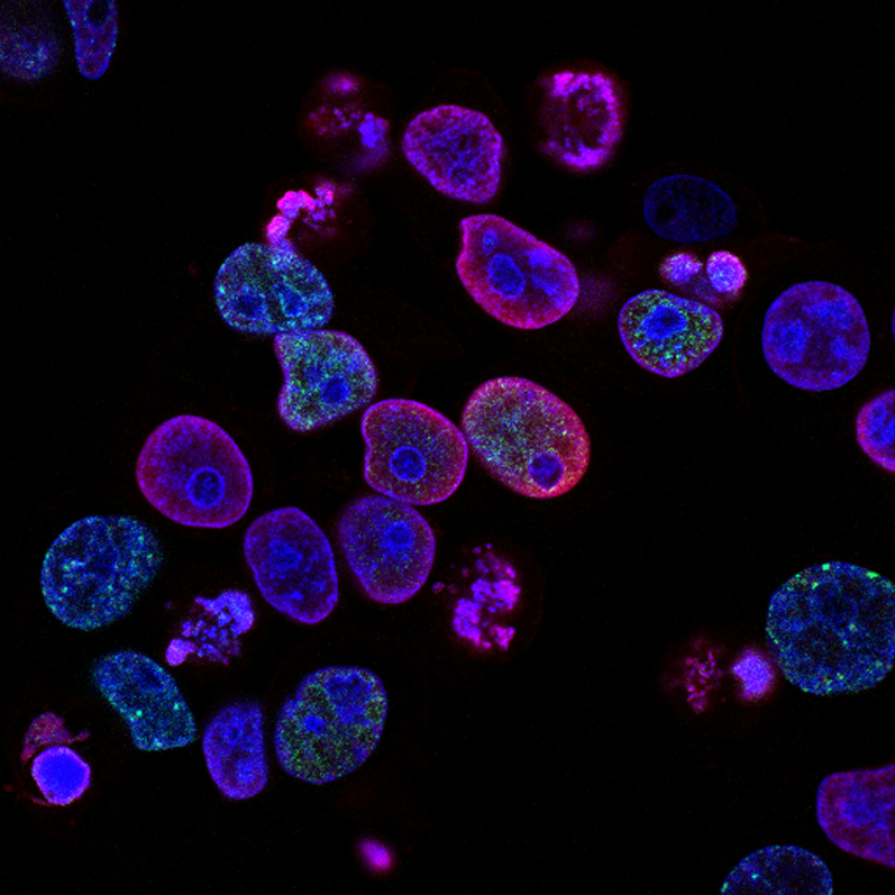 Human colorectal cancer cells - circular shapes in shades of purple, pink, blue and green, on a black background